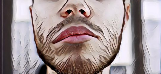 7 Fakta Tentang Stroke yang Harus Kamu Tahu Dari Dokter Ahli, Selain Gejala Umum