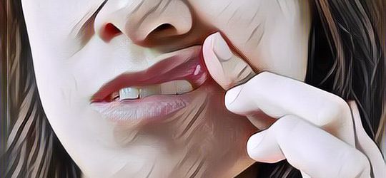 Obati Sariawan Secara Alami dengan 10 Ramuan Ini, Dijamin Ces Pleng!