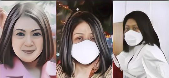 Putri Candrawathi Istri Ferdy Sambo Diduga Lakukan Malingering, Apa Pengertiannya?