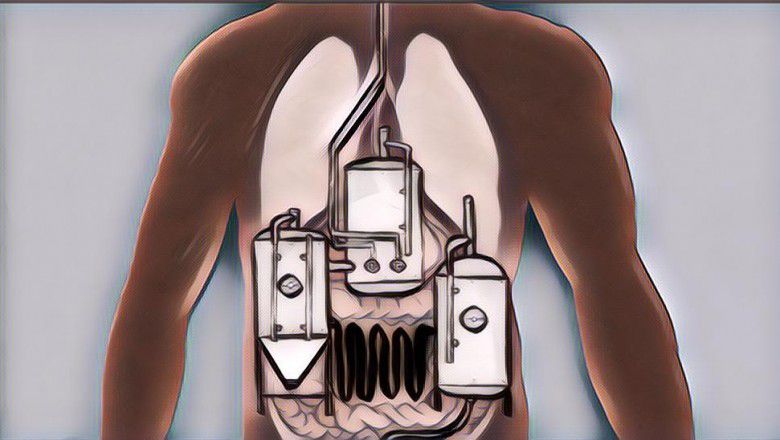 Orang Pertama Di Dunia, Wanita Bisa Bikin Alkohol Di Dalam Tubuhnya, Bisa Diminum?