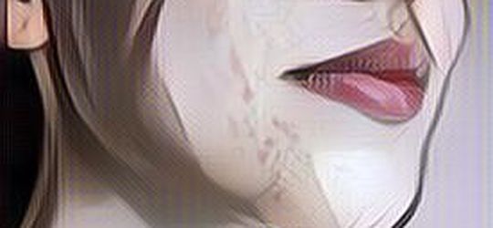 Bekas Jerawat Bisa Hilang Berapa Lama? Begini Kata Pakar dan Solusinya