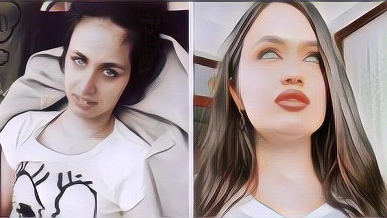 8 Tahun Berlalu! Gini Kondisi Iron Woman Turki Yang Ditembak Kepalanya Gegara Tolak Lamaran