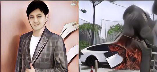 Muncul Pertama Kali Setelah Kecelakaan Mobil, Tubuh Kurus Kakak Boboho Di Hari Ulang Tahun Jadi Sorotan