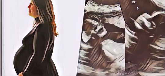 Mukjizat! Punya Rahim Ganda, Wanita Ini Bisa Hamil di Kedua Rahimnya Sekaligus