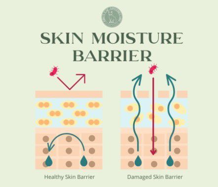 Mengenal Apa Itu Skin Barrier dan Cara Melindunginya | Paragram.id