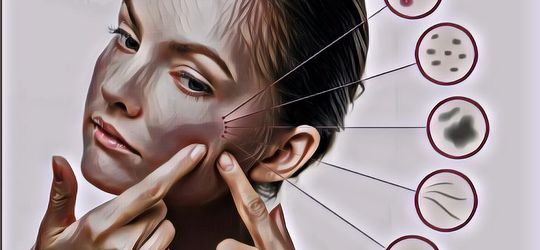 Jangan Diabaikan! Ternyata, Ini 7 Tanda Kulitmu Nggak Cocok Saat Memakai Skincare