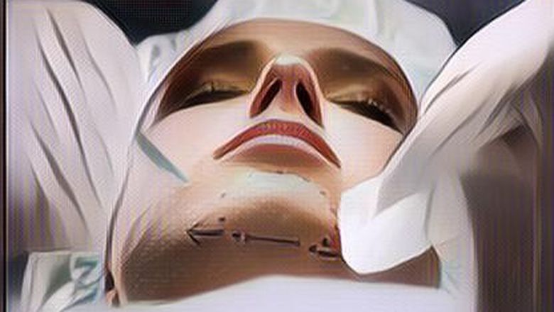 Seorang Wanita Depresi Usai Dagunya Alami Infeksi Parah Pasca Operasi