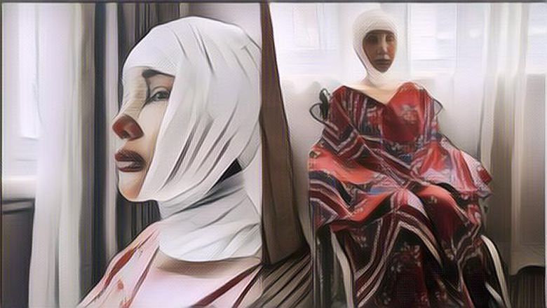 Suara Pertama Lucinta Luna Usai Operasi Potong Leher dan Tulang Ekor: Semoga Dapat Kecantikan Terhakiki