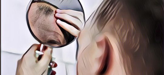 Tips dan Trik Menyuburkan Rambut Agar Lebat dan Kuat