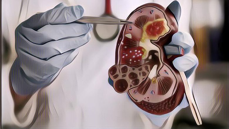 5 Kebiasaan Anak Muda yang Ternyata Bisa Berbahaya untuk Ginjal! Apa Saja?