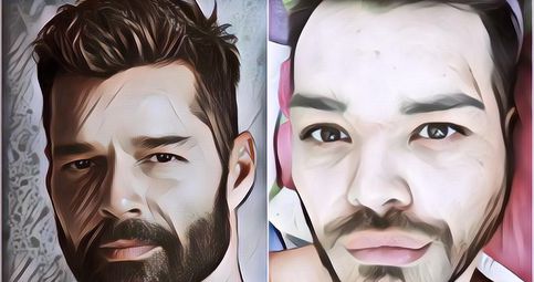 Demi Bisa Mirip Ricky Martin, Pria Ini Malah Nekat Injeksi Oli ke Wajahnya