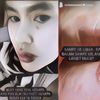 Kartika Putri Alami Kondisi Wajah yang Mengerikan Akibat Alergi, Netizen: Kena Ain?