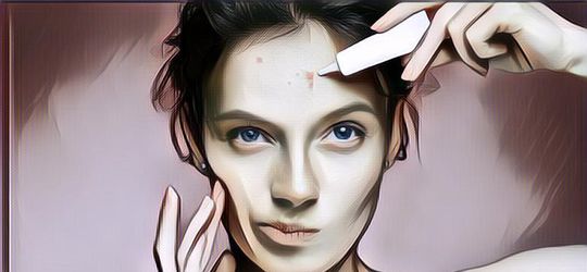 Bebas dari Jerawat dengan Pola Hidup Sehat, Bagaimana Caranya?