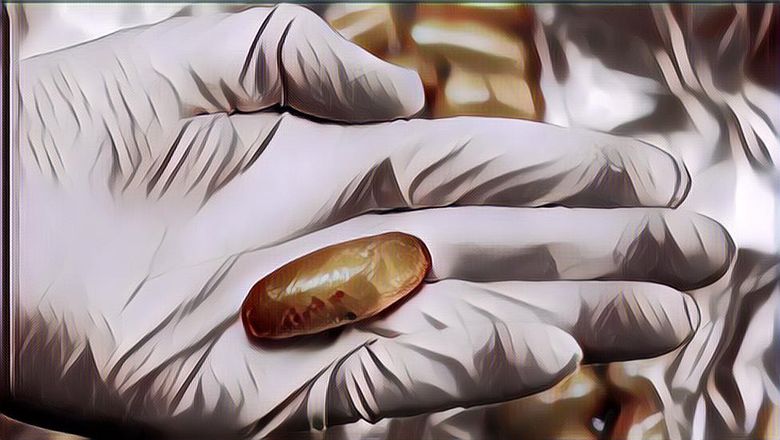 Parah! Seorang Pria Sembunyikan Narkoba di Kondom dan Anus, Tapi Tetap Diciduk BNN Kok