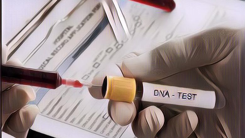 Segini Kisaran Biaya Tes DNA, Denny Sumargo Turuti Keinginan Verny?