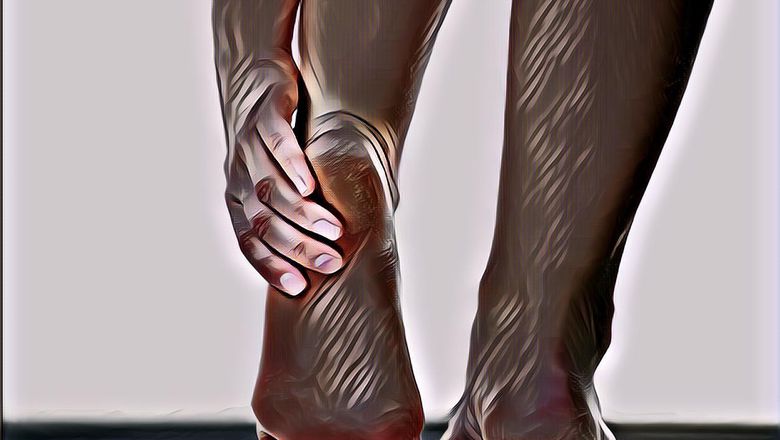 4 Langkah Menyembuhkan Tumit Pecah-Pecah, Menurut Ahli Penyakit Kaki