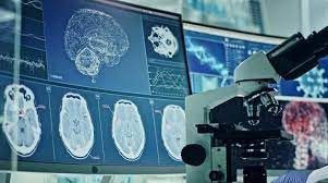 # Apa Itu Aneurisma Otak?