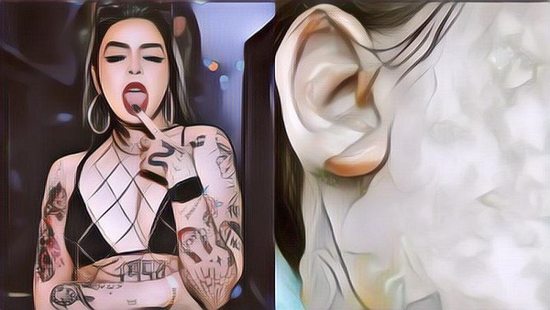 Tragis! Gini Kronologi DJ Seksi Alami Luka Bakar Serius Gara-gara Panci Meledak Saat Kencan Sama Pacar