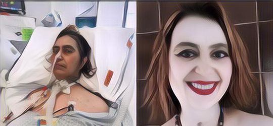 Kronologi Wanita Nyaris Alami Kelumpuhan Dan Hampir Meninggal Gara-gara Makan Saus Pesto