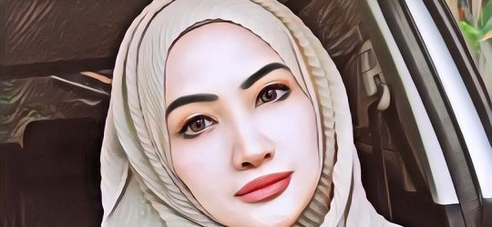 Natalie Sarah Jalani Operasi Akibat KET, Apa Itu Kehamilan Ektopik Terganggu?