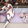 Hidungnya Berdarah Kena Bola Tendangan Kylian Mbappe, Wanita Ini Dapat Kejutan Usai Pertandingan