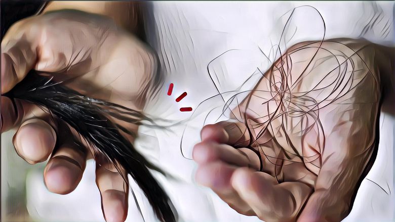 Simak Cara Mengatasi Rambut Rontok ala dr Zaidul Akbar Berikut Ini