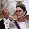Kate Middleton Idap Kanker Usus Besar? Ini Dugaan Faktanya