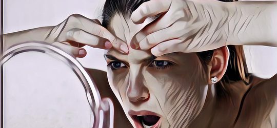 Cara Menghilangkan Jerawat Batu tanpa Harus Kesakitan karena Mencetin Satu-Satu