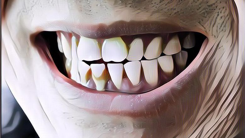 Mudah Didapat di Rumah, Ini 5 Bahan Alami Untuk Bersihkan Karang Gigi, Dari Baking Soda Sampai Garam
