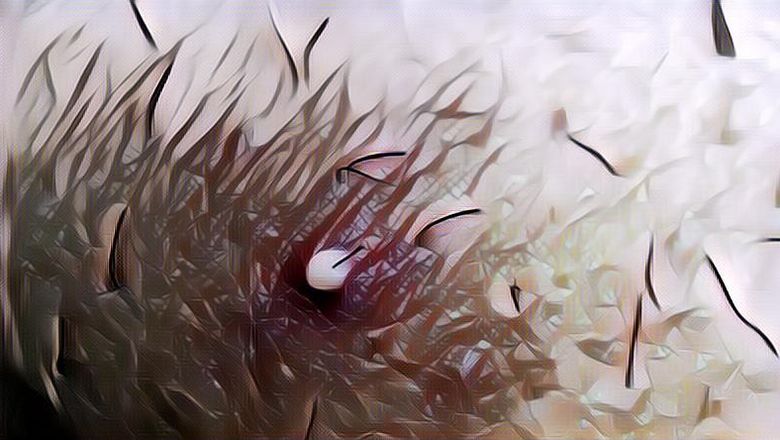 Penyebab dan Pencegahan Jerawat pada tubuh dan Punggung