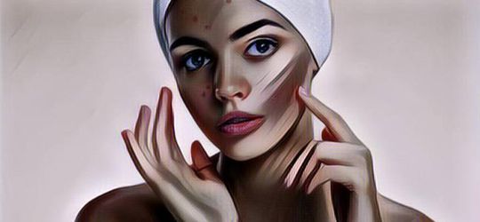 Berhenti Konsumsi Susu Bisa Mengatasi Jerawat, Apa Benar?