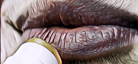 5 Hal Yang Menyebabkan Bibir Kering dan Pecah, Menjilat Bibir Bikin Lebih Parah