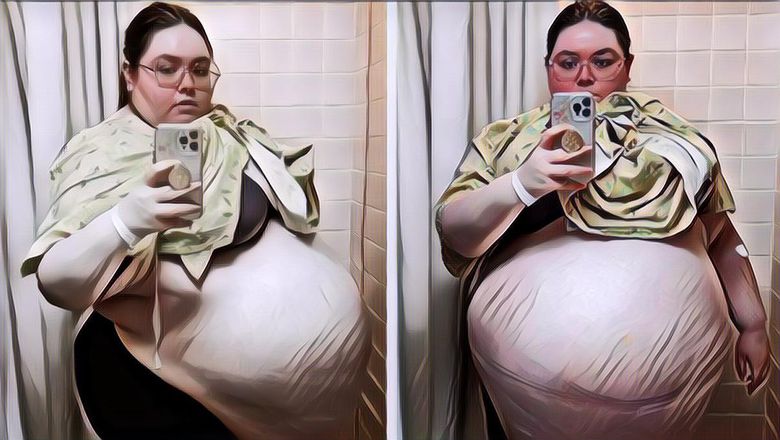 Bikin Syok! Wanita Ini Punya Kista dengan Ukuran 47 Kg!