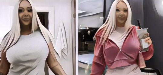 Khawatir Gak Jadi Orang Sukses, Wanita Ini Lakukan Oplas Hingga Habiskan Rp 1 M