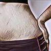 Bikin Makin Percaya Diri, Ini 4 Rekomendasi Body Oil Untuk Menghilangkan Stretch Mark