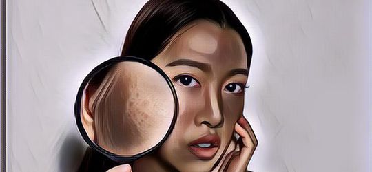 Rekomendasi Produk Penghilang Flek Hitam yang Diklaim Efektif, Bisa Dicoba Nih!