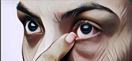 9 Cara Menghilangkan Kantung Mata Secara Alami, Ampuh Banget!