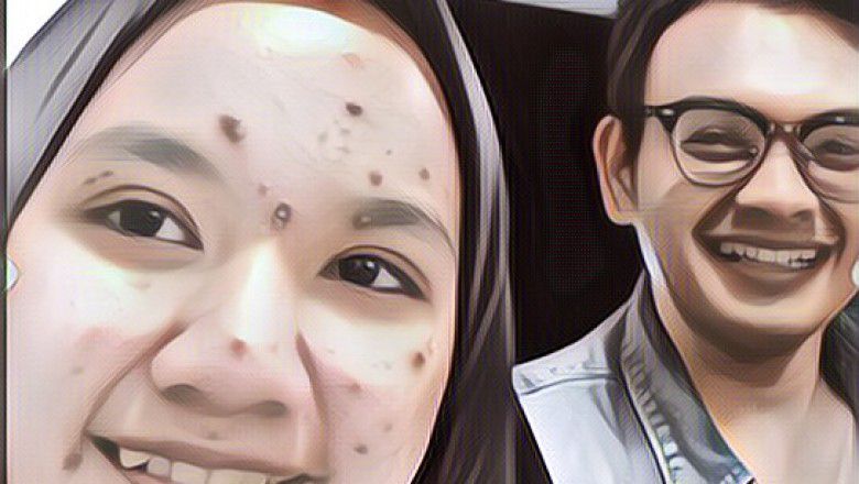 Viral Postingan Cowok Kasih Semangat Pacar yang Wajahnya Jerawatan Parah