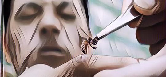 Sengatan Lebah Bisa Digunakan Sebagai Pengobatan Untuk Manusia, Hoax atau Fakta?