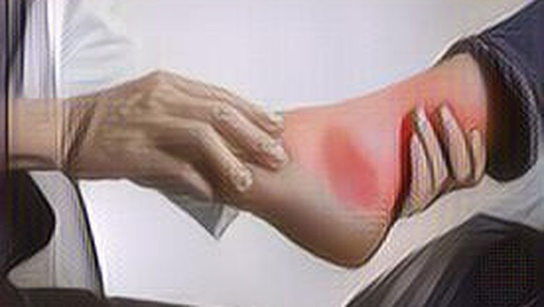 4 Makanan Yang Bisa Bikin Asam Urat Kambuh. Hindari Konsumsi Makanan Ini Secara Berlebihan!