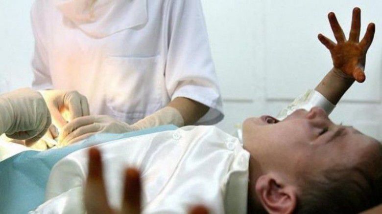 Lalu usia ideal anak laki laki sunat gimana ya?