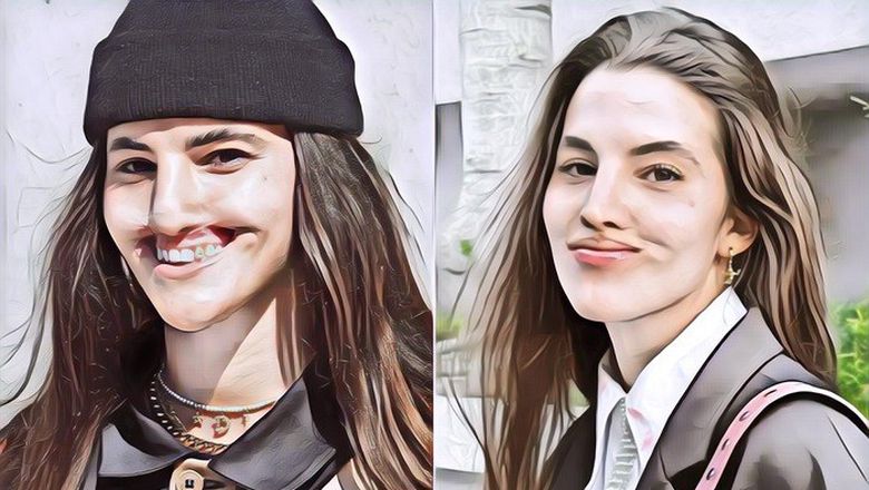 Bibirnya Lepas Digigit Anjing, Gini Penampilan Terbaru Model Cantik Ini Usai Jalani Oplas Rp6 M