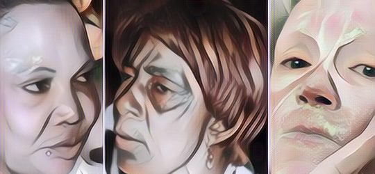 Awas, Salah Memakai Masker Pemutih Wajah Bisa Berakibat Fatal