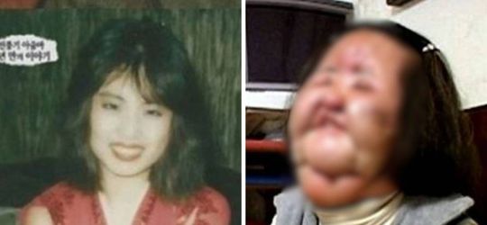 Bikin Nyesek! Aktris Korea Ini Punya Wajah yang Hancur Gara-Gara Gagal Oplas