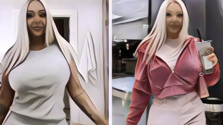 Khawatir Gak Jadi Orang Sukses, Wanita Ini Lakukan Oplas Hingga Habiskan Rp 1 M