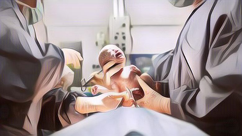 Caesar Ternyata Sama Beratnya dengan Persalinan Normal, Ini Fakta-Fakta yang Perlu Diketahui