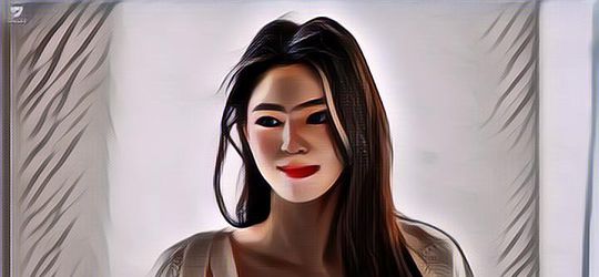 Aktris Han So Hee Ungkap Dirinya Baru Saja Jalani Operasi Hidung, Sakit Apa?