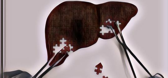 Penyakit pada Hati Paling Mematikan, Ketahui Pencegahannya Sebelum Terlambat