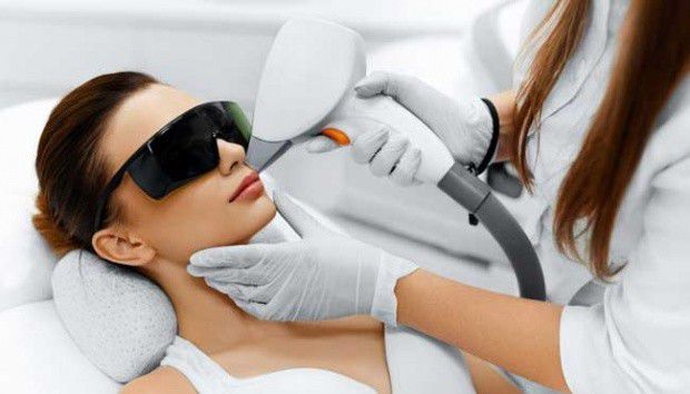 Apakah Pico Laser Treatment Perlu Diulang?