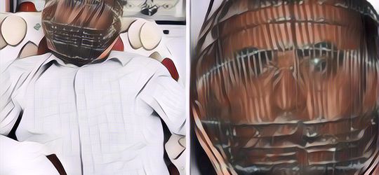 Tak Disangka, Pria Ini Rela Mengurung Kepalanya dengan Sangkar Agar Bisa Berhenti Merokok